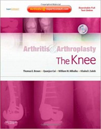 Arthritis & arthroplasty the knee