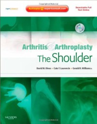 Arthritis & arthroplasty the shoulder