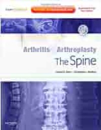 Arthritis & arthroplasty the spine